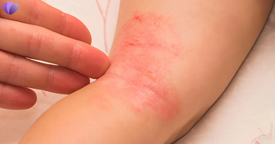 Candida vs Parasites: What’s the Difference and How Are They Diagnosed?