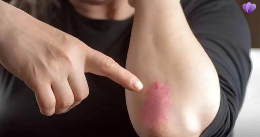 Parasites and Anemia: Low Iron, Symptoms, Causes and Testing